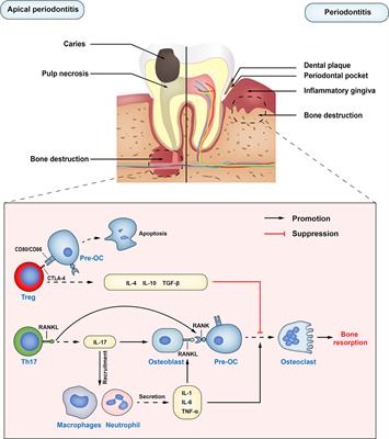 Treg: A Promising Immunotherapeutic Target in Oral Diseases